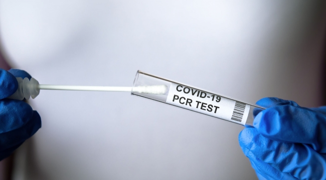 KKTC’de aşısız kişilerin PCR testleri ücretli olacak