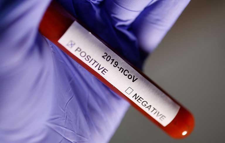 Güney Kıbrıs’ta koronavirüs salgını… 569 yeni vaka